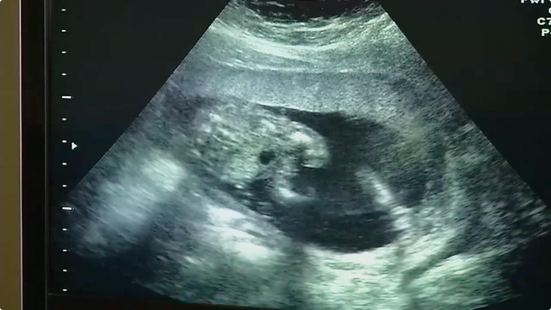 Alabama Supreme Court rules embryos are children